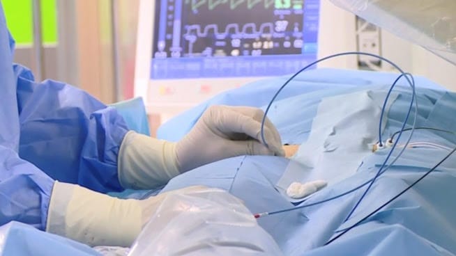 Zbliżenie na zabieg chirurgiczny, ukazujące dłoń w rękawiczce i sprzęt medyczny.