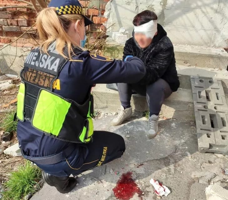 Policjant pomaga rannej kobiecie z raną głowy. Na ziemi widać krew.