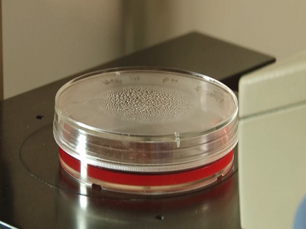 Płytka Petriego z czerwonym agarem i kondensacją na pokrywce