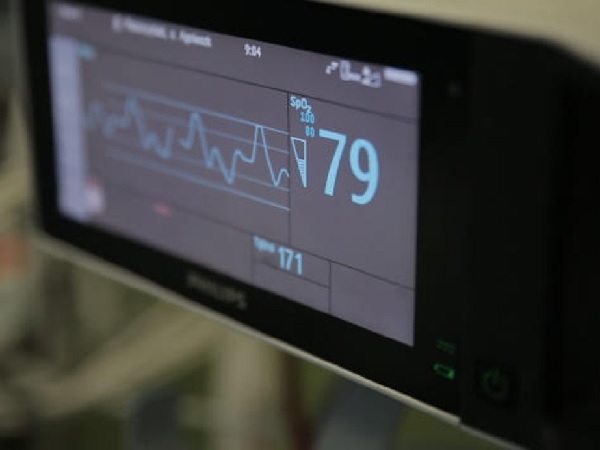 Monitor medyczny pokazujący tętno 79 uderzeń na minutę.