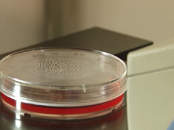 Płytka Petriego ze skroploną wodą ukazująca wzrost bakterii.