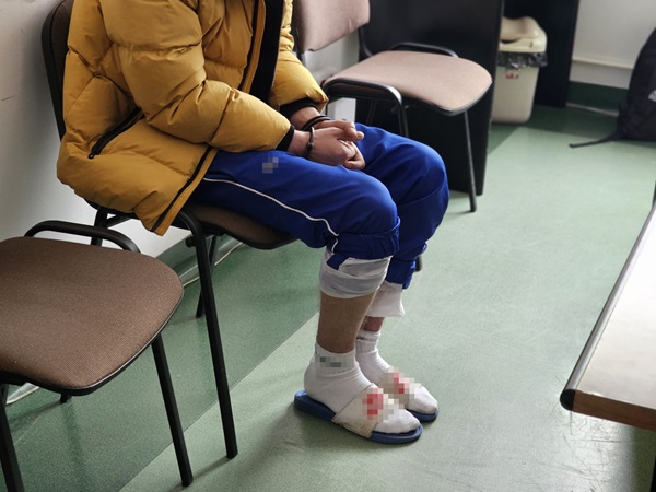 Skuta kajdankami osoba siedząca w poczekalni, ubrana w żółtą kurtkę i niebieskie spodnie dresowe.